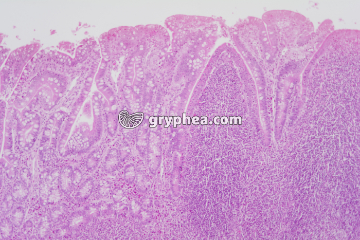 Plaque de Peyer x25 - gryphea.com